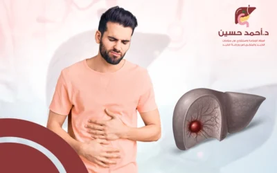 ما اعراض بؤرة الكبد؟ وما وسائل علاجها؟
