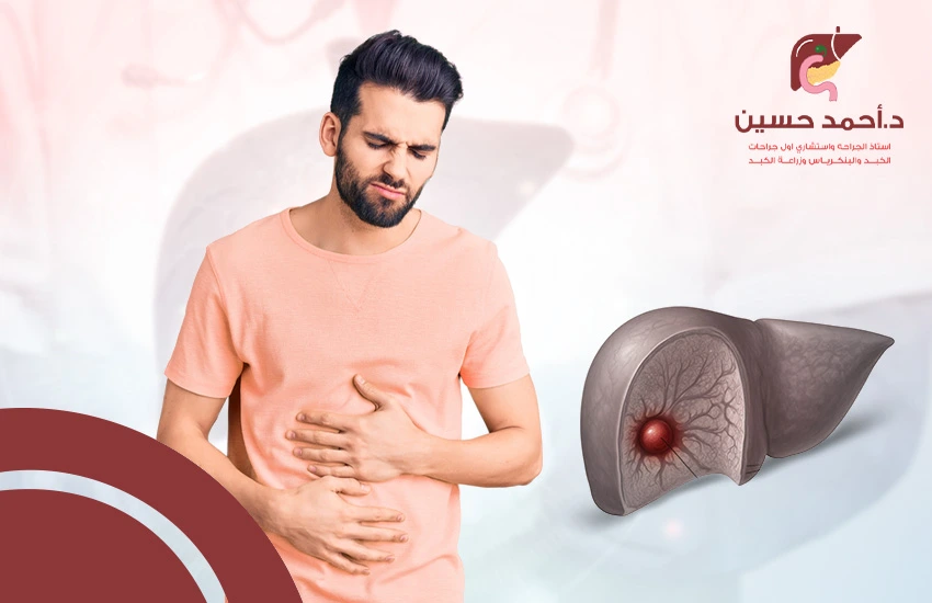 اعراض بؤرة الكبد