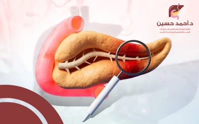 أعراض ورم البنكرياس الخبيث… أعراض لا يُستهان بها