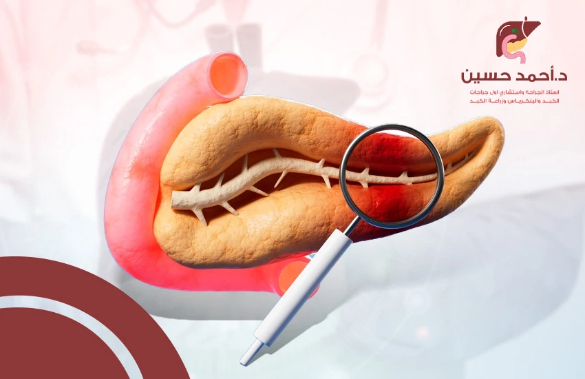 أعراض ورم البنكرياس