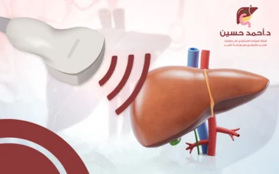 الأشعة التداخلية للكبد