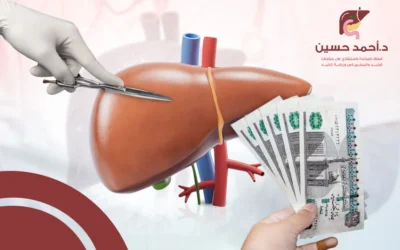 عوامل تؤثر بقوة في تكلفة زراعة الكبد في مصر