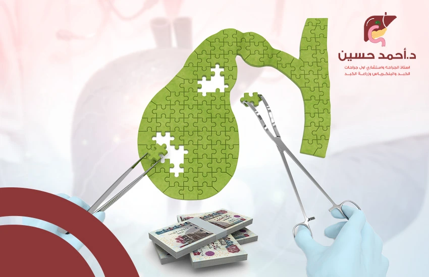 تكلفة عملية المرارة بالجراحة