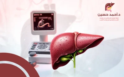 مضاعفات التردد الحراري للكبد | حدوثها نادر وقابلة للعلاج