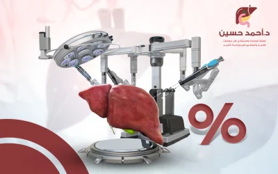 نسبة نجاح عملية زراعة الكبد، وأهم النصائح لرفعها
