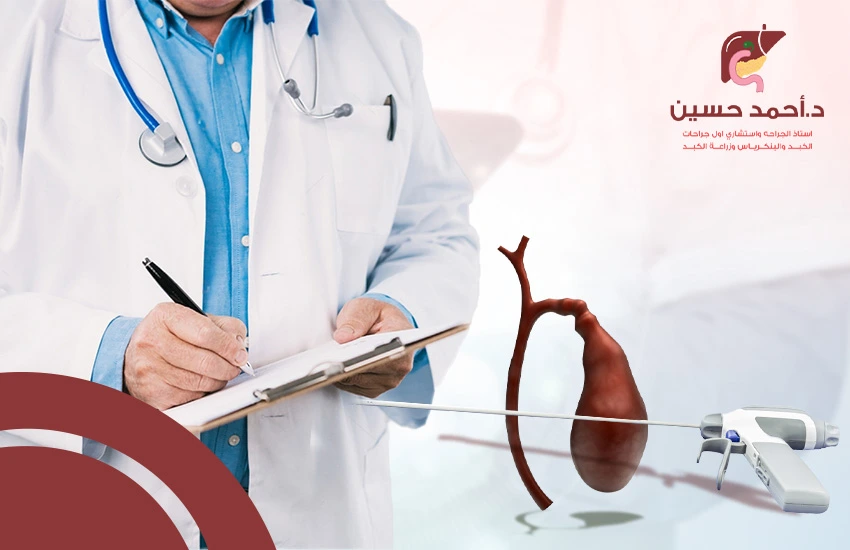 نصائح بعد استئصال المرارة بالمنظار