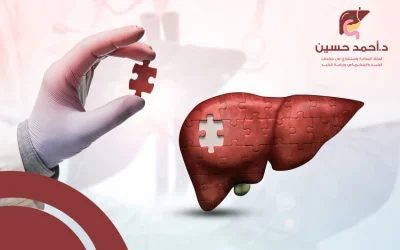 هل ينمو الكبد بعد استئصال جزء منه؟ لغز الطبيعة الذي يذهل العلماء