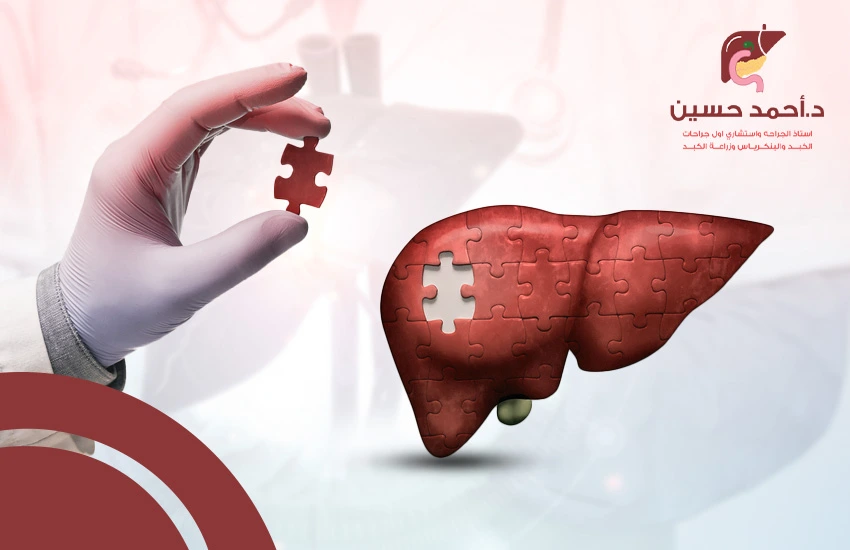 هل ينمو الكبد بعد استئصال جزء منه