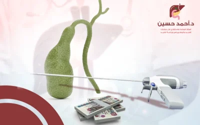 إليك العوامل المؤثرة في تكلفة ازالة المرارة بالمنظار