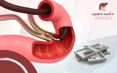 العوامل المؤثرة في تكلفة منظار القنوات المرارية