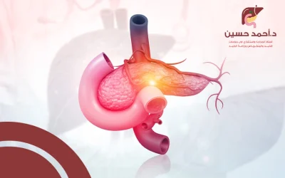 سرطان الطحال