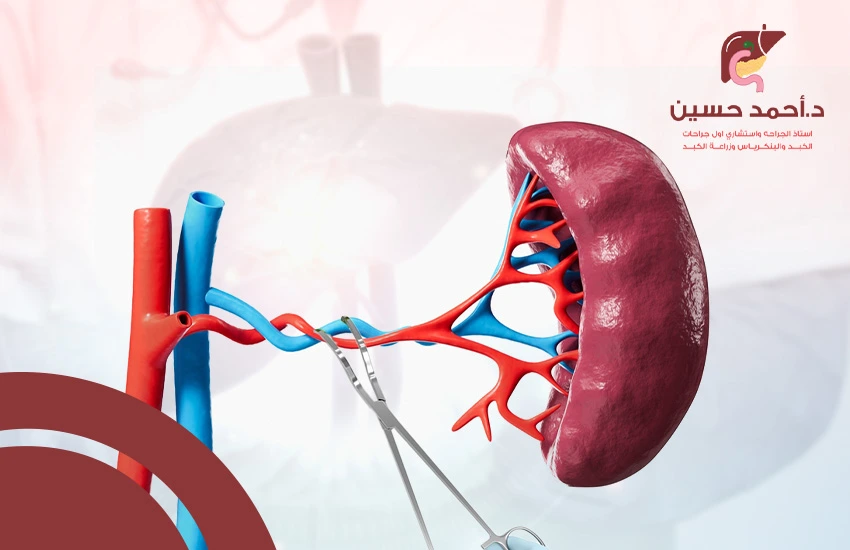 استئصال الطحال