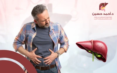 شكل بطن مريض الكبد .. ليست العلامة الوحيدة على تقدم المرض