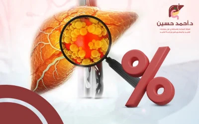 كم تبلغ نسبة شفاء سرطان الكبد؟