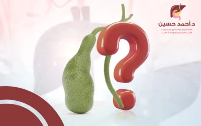 هل عملية المرارة خطيرة؟ إجابة شاملة تطمئنك