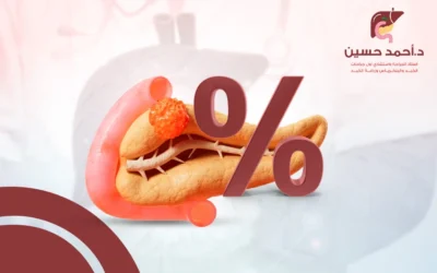 التطورات الحديثة ودورها في رفع نسبة الشفاء من سرطان البنكرياس
