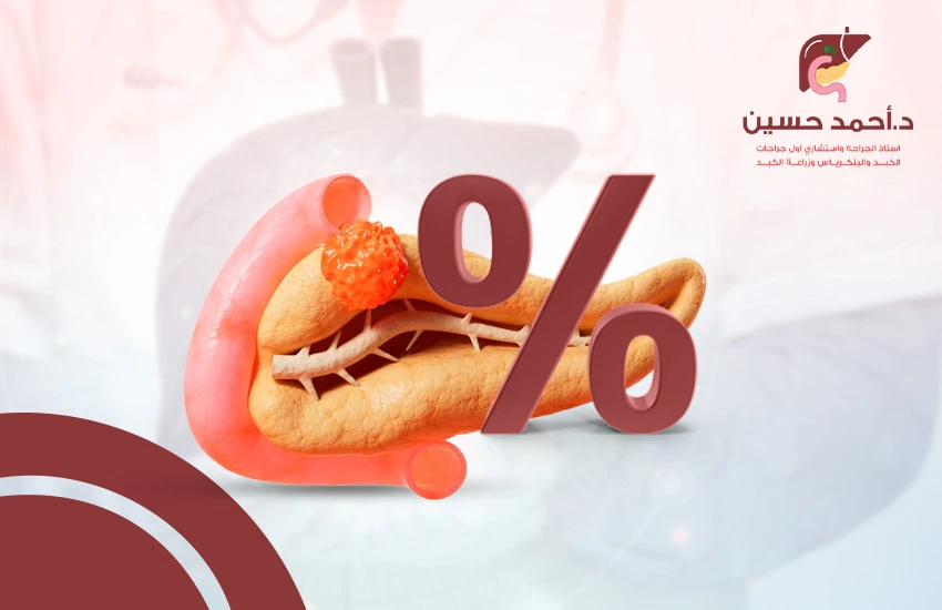 نسبة الشفاء من سرطان البنكرياس