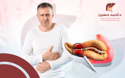 ما هي أعراض سرطان البنكرياس المرحلة الأولى؟