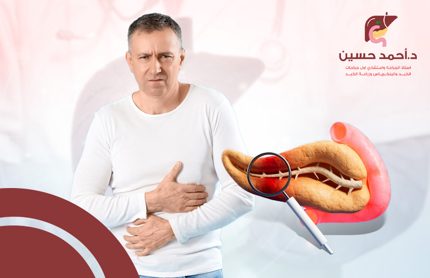 أعراض سرطان البنكرياس المرحلة الأولى