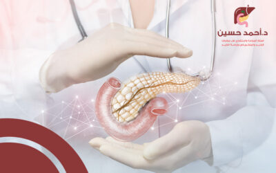 أفضل دكتور لعلاج سرطان البنكرياس في مصر