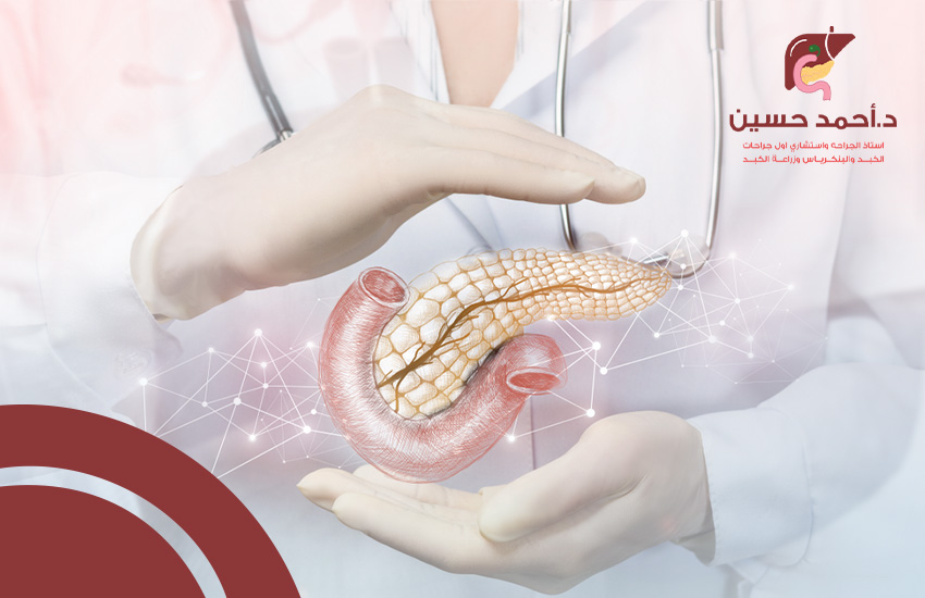 أفضل دكتور لعلاج سرطان البنكرياس في مصر