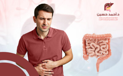 ما الفرق بين أعراض سرطان القولون والقولون العصبي؟