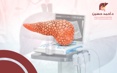 هل السونار يكشف سرطان البنكرياس؟