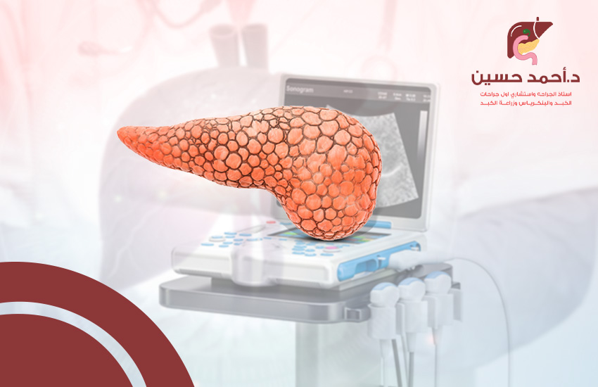 هل السونار يكشف سرطان البنكرياس