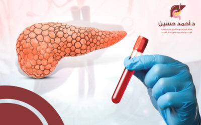 هل سرطان البنكرياس يظهر في تحليل الدم؟ إليك الإجابة الوافية