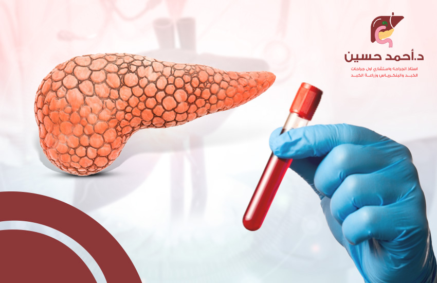 هل سرطان البنكرياس يظهر في تحليل الدم