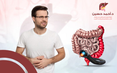 ما هي اضرار منظار القولون؟