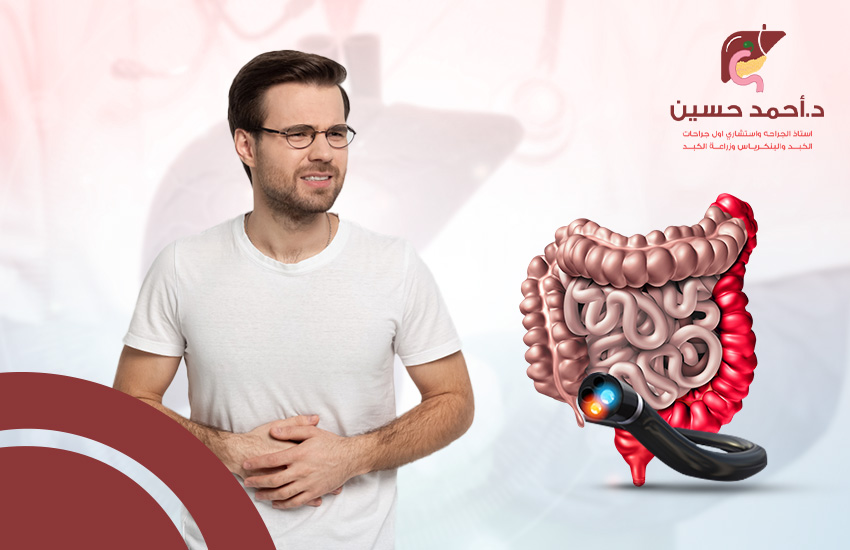 اضرار منظار القولون