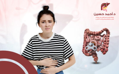 أشهر اعراض القولون العصبي عند النساء وعلاجه