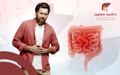 اعراض القولون المتهيج وكيفية التعايش معه دون عناء