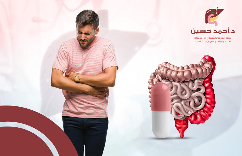علاج القولون العصبي للابد