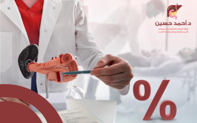 إليك أهم العوامل المؤثرة في نسبة نجاح عملية استئصال البنكرياس