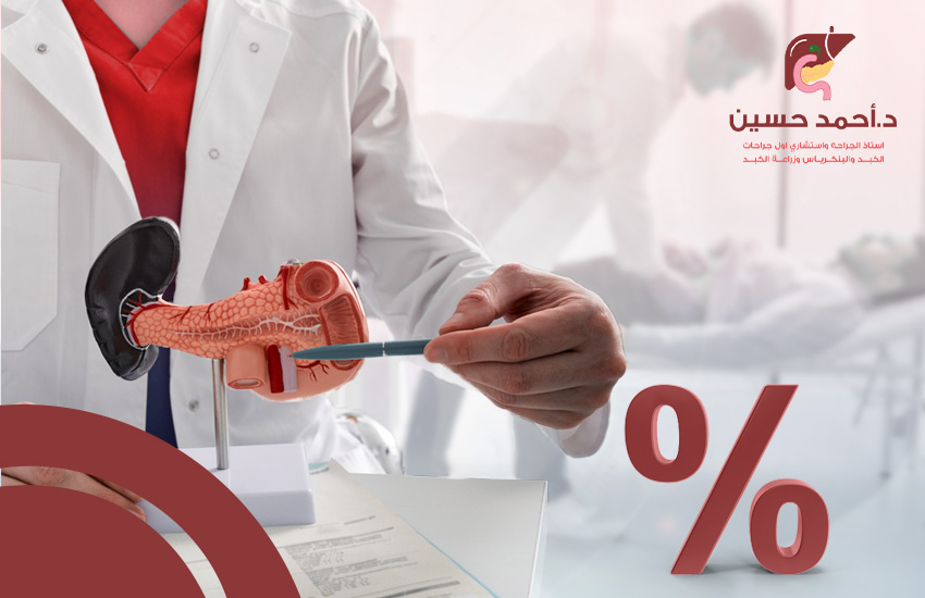 نسبة نجاح عملية استئصال البنكرياس