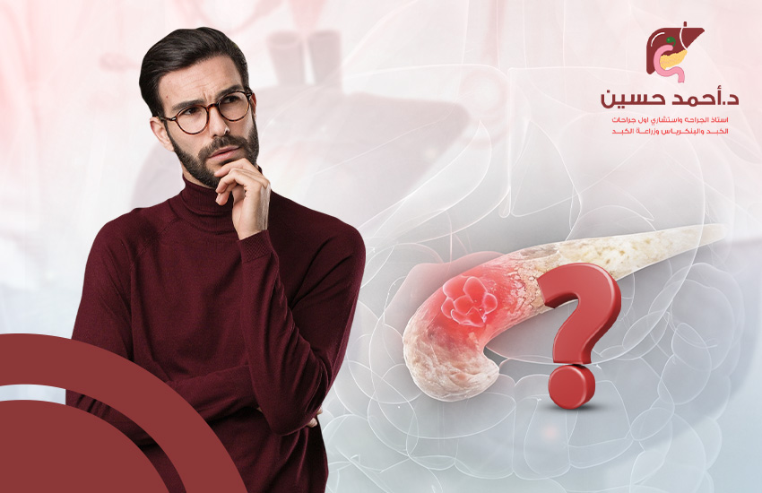 اسباب سرطان البنكرياس