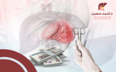 كيف تُحدد تكلفة عملية استئصال الطحال؟