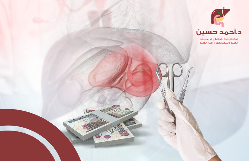 تكلفة عملية استئصال الطحال