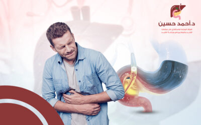 ما هي المضاعفات بعد منظار القنوات المرارية؟