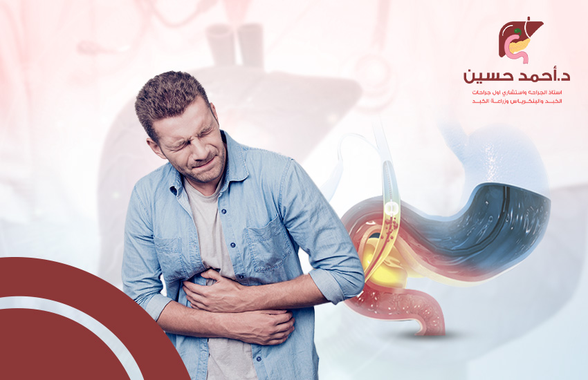 مضاعفات بعد منظار القنوات المرارية