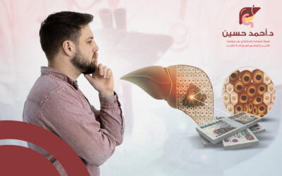 مدى تأثير خبرة الطبيب في تكلفة عملية استئصال جزء من الكبد