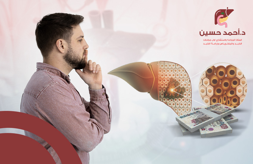 تكلفة عملية استئصال جزء من الكبد