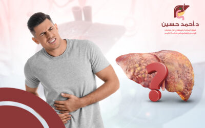 هل يشفى مريض تليف الكبد؟