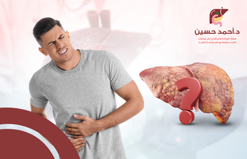 هل يشفى مريض تليف الكبد