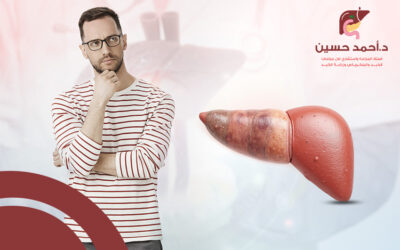 كل ما تود معرفته عن درجات تليف الكبد وأسباب المرض وعلاجه