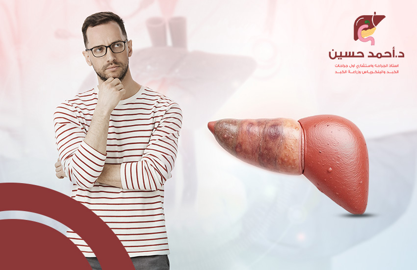 درجات تليف الكبد