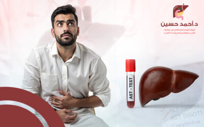 متى نقلق من ارتفاع انزيم الكبد؟ إليك الأسباب وسبل العلاج
