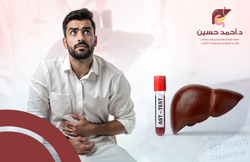 متى نقلق من ارتفاع انزيم الكبد